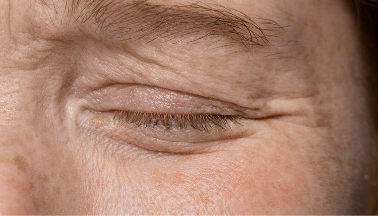Compounded Hair Loss Formulations