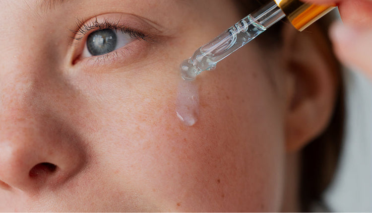 Hydroquinone for Melasma