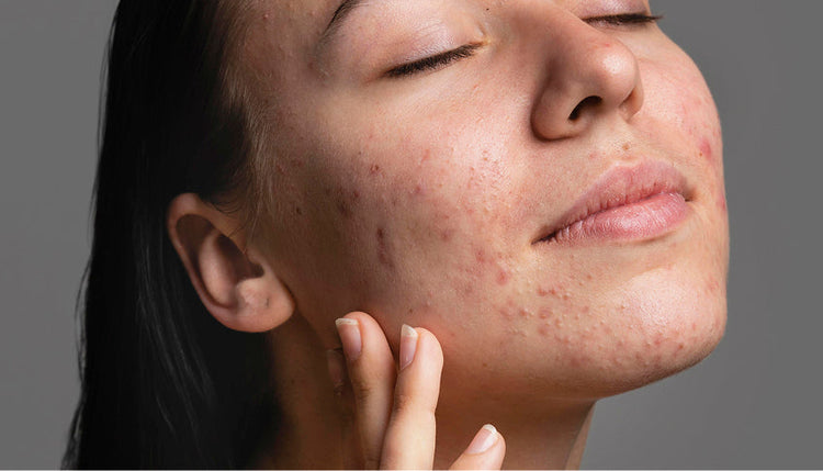 Peptides in Skin Formulations